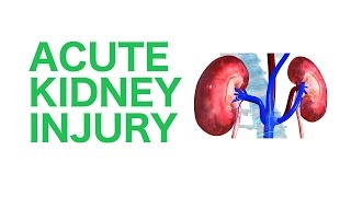 Acute Kidney Injury AKI  USMLE [upl. by Laup]