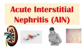 Nephrotic Syndrome  Types and pathology histology [upl. by Nodnyl]