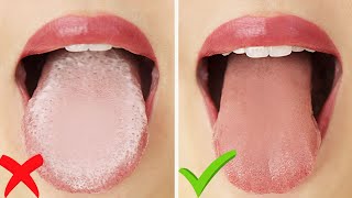 HOW TO Get Rid of White Tongue amp Bad Breath INSTANTLY [upl. by Philly]