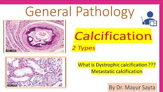 Pathological Calcification [upl. by Introc215]