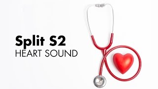 Fixed Split S2  Heart Sounds  MEDZCOOL [upl. by Jenica706]