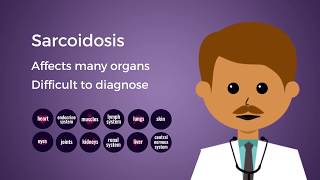 CHEST Foundation Sarcoidosis – What are the Symptoms [upl. by Mckay]