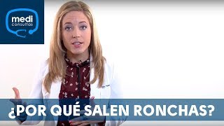 Ronchas ¿por qué aparecen MediConsultas [upl. by Elvina]