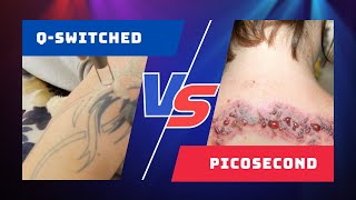 Picosecond VS Q Switched Lasers  Whats The Difference [upl. by Sweyn991]