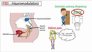 Nephrotic vs Nephritic Syndrome Proteinuria Hematuria Casts [upl. by Danya]