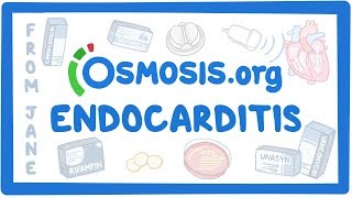 Sarcoidosis 101  American Lung Association [upl. by Pepita]