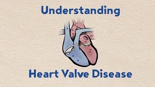 Understanding Heart Valve Disease [upl. by Ardnasirk]