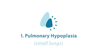 DIAPHRAGM PART 1 WITH CLINICAL ASPECTS  SANJOY SANYAL [upl. by Gervase47]