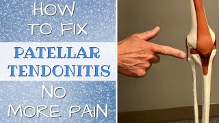 How To Fix Patellar Tendonitis No More Pain amp Self Treatment [upl. by Tuttle131]