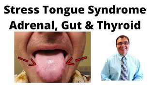 Stress Tongue Syndrome Adrenal Gut amp Thyroid [upl. by Annairol]