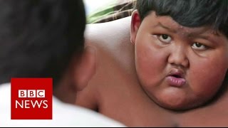 My 10yearold son weighs 188kg  BBC News [upl. by Kele773]