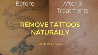 How To Remove Tattoos Naturally [upl. by Nire]