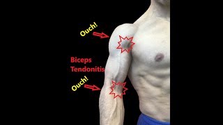 Biceps Tendonitis Treatment At Home Relieve Pain Fast [upl. by Mccallum]