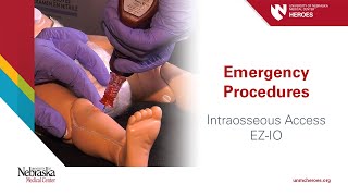 Emergency Procedures Intraosseous Access  EZIO [upl. by Linnea]