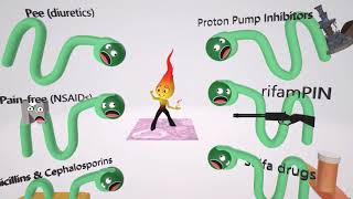 Acute Nephritic Syndrome Fundamentals – Nephrotic Syndrome  Lecturio [upl. by Ayian]