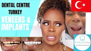 I HAD MY TEETH DONE IN TURKEY PART 1  DENTAL CENTRE TURKEY  Hollywood Smile Makeover  Veneers [upl. by Kimbra]