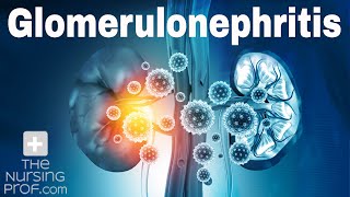 Renal Emergencies Glomerulonephritis [upl. by Jarrett332]