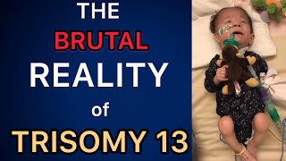 The BRUTAL Reality of Having a Trisomy Child Trisomy 13 amp 18 13トリソミー [upl. by Ramsey]