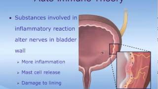 Understanding Interstitial Cystitis IC [upl. by Nomelif]