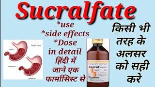 Sucralfate suspension  Uses Side effects Dose and precautions In Hindi [upl. by Cirri]