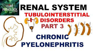 CHRONIC PYELONEPHRITIS  PATHOLOGY [upl. by Royce]