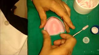 denture base preparation [upl. by Hildegard]