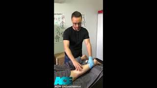 Myofascial Dry Needling of the Gastrocnemius [upl. by Breana554]