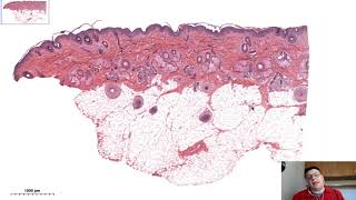 Histologia da Pele [upl. by Saval367]