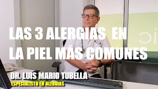 Los 3 tipos de ALERGIAS EN LA PIEL más comunes ⭐ ¿ Se cura la Dermatitis  ⭐ SmartSalus [upl. by Nevetse]