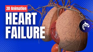 What is a Coronary Angioplasty  Balloon Angioplasty  3D Animation [upl. by Rudin549]