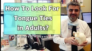 How To Look For Tongue Ties In Adults [upl. by Aek]