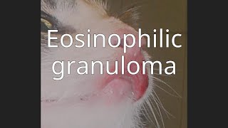 Eosinophilic granuloma [upl. by Aelanna586]