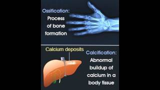 Ossification Vs Calcification [upl. by Llednahs694]