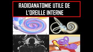 Radioanatomie utile de loreille interne [upl. by Parsifal]