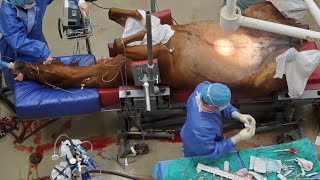 GRAPHIC Horse Emergency Colic Surgery Jejunostomy [upl. by Earehc]