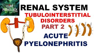 ACUTE PYELONEPHRITIS Pathology [upl. by Ardnwahsal]