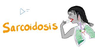 Sarcoidosis  a Mystery Disease [upl. by Robinetta545]