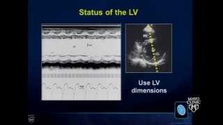 Anatomy 2 Part 3 Heart Valves and Valvular Disease [upl. by Eob]