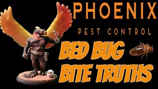 Bed Bug Bites Exposed What You Need to Know [upl. by Rubi]