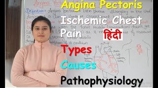 Angina Pectoris in Hindi  Ischemic Chest Pain  Types of Angina  Causes  Pathophysiology  Part 1 [upl. by Agate]