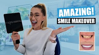 Smile Makeover Review All on 6 Dental Implants  Veneers Turkey [upl. by Atteirneh]