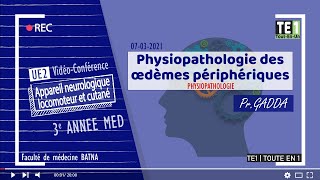 PHYSIOPATHOLOGIE  Physiopathologie des œdèmes périphériques [upl. by Ameluz]