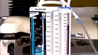 Atriums Ocean Chest Drain Setup and Operation Part 3 [upl. by Ariaek]