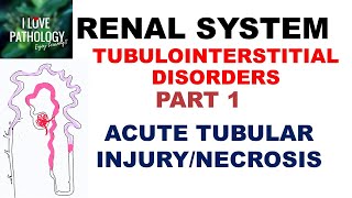 Pyelonephritis Kidney Infection  Causes Pathophysiology Signs amp Symptoms Diagnosis Treatment [upl. by Ainafets636]