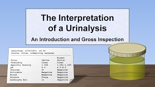 Urine analysis Part 2 chemical examination [upl. by Elene]