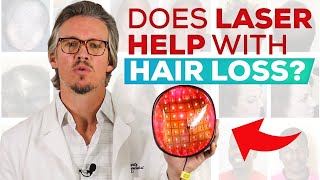 Laser Treatment For Hair Loss And Hair Regrowth Does It Work QampA [upl. by Emalia364]